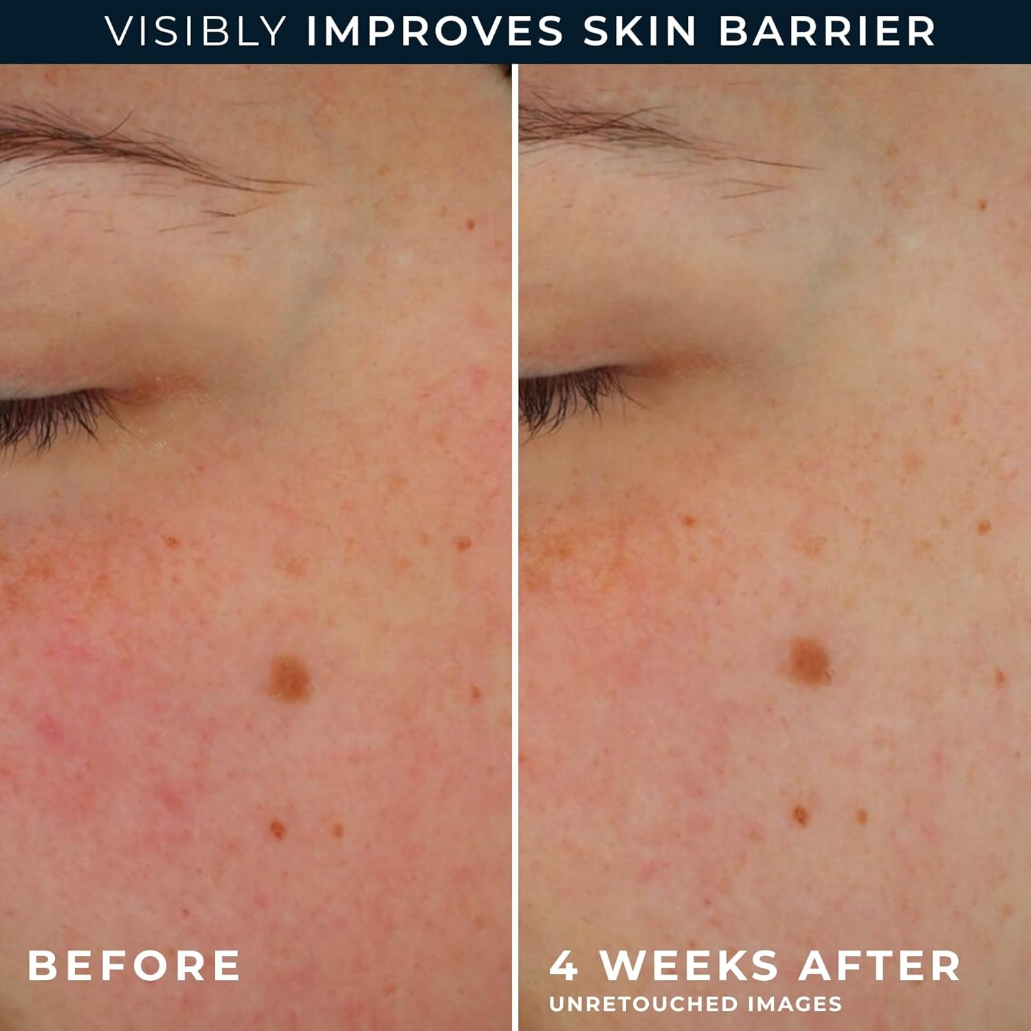 image:imageRoC Barrier Renew Night Moisturizer with Ceramides amp Antioxidant Green Tea and Lipo Peptides to Renew Skin Barrier 25 oz with Retinol Eye Cream PacketteBarrier Renew Day Cream
