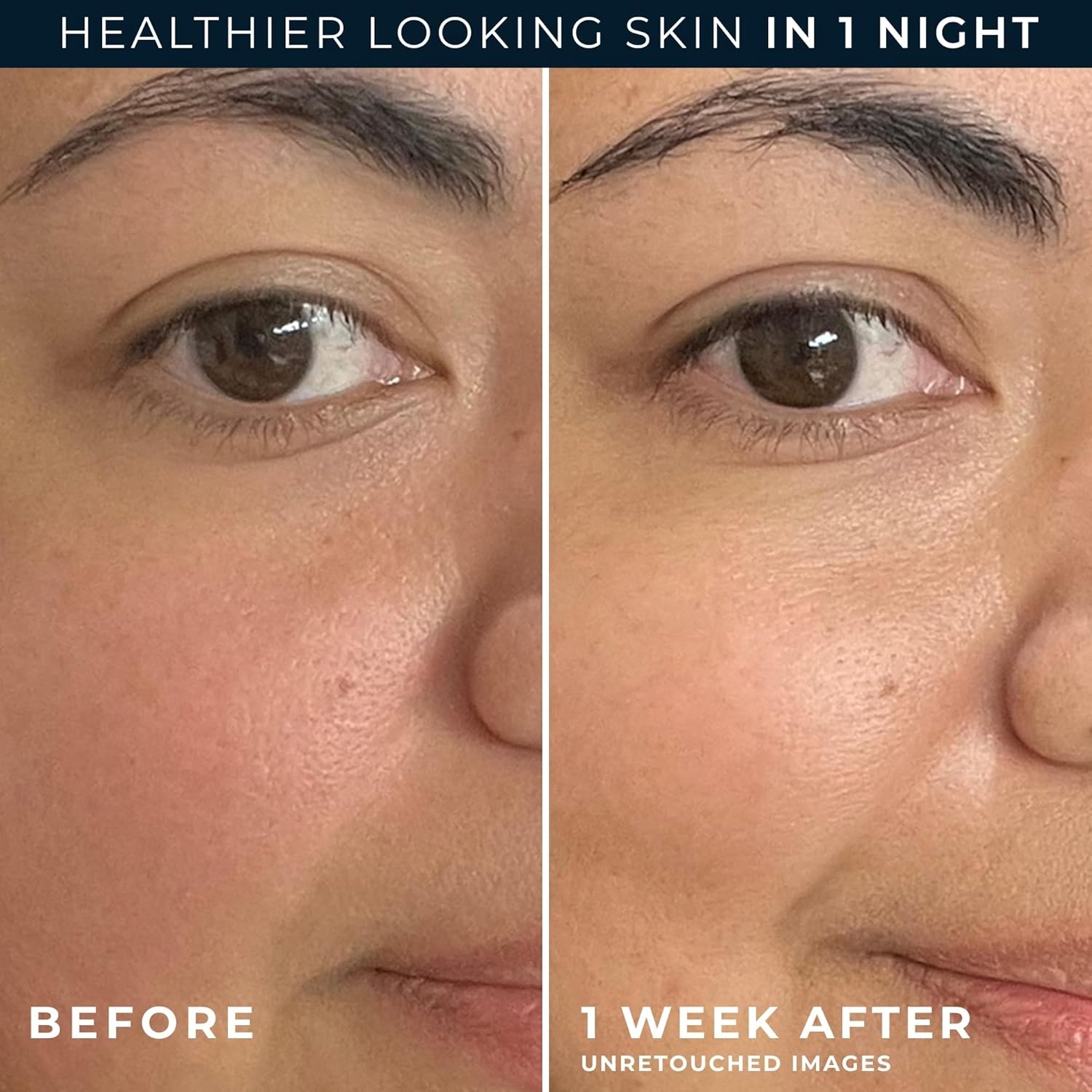 image:imageRoC Barrier Renew Night Moisturizer with Ceramides amp Antioxidant Green Tea and Lipo Peptides to Renew Skin Barrier 25 oz with Retinol Eye Cream PacketteBarrier Renew Night Moisturizer