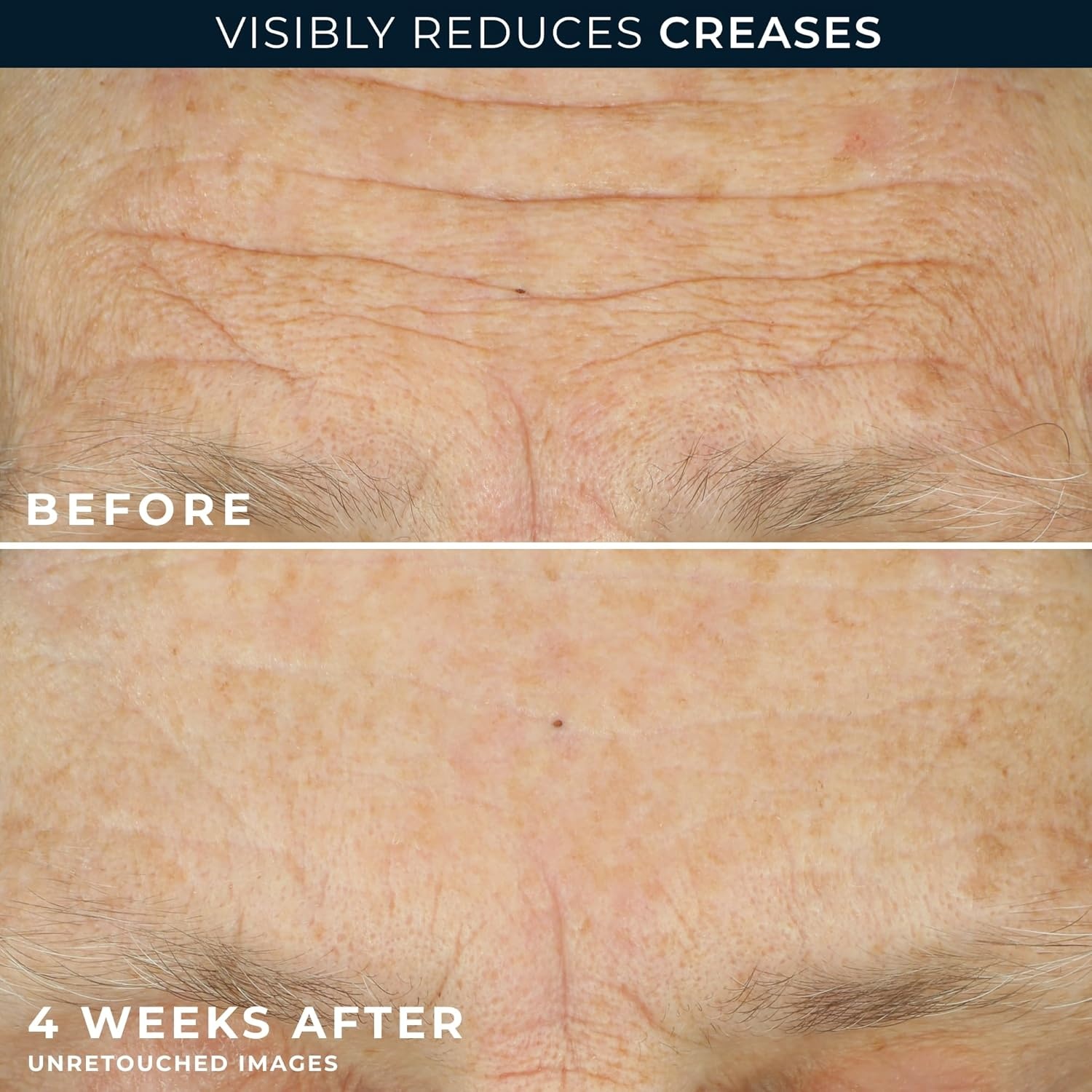 image:imageRoC Crepe Repair Anti Aging Daily Face Moisturizer amp Neck Firming Cream 17 oz RoC Retinol Wrinkle Smoothing Capsules 7 CT Skin Care Routine for Women and Men1 Count Pack of 1