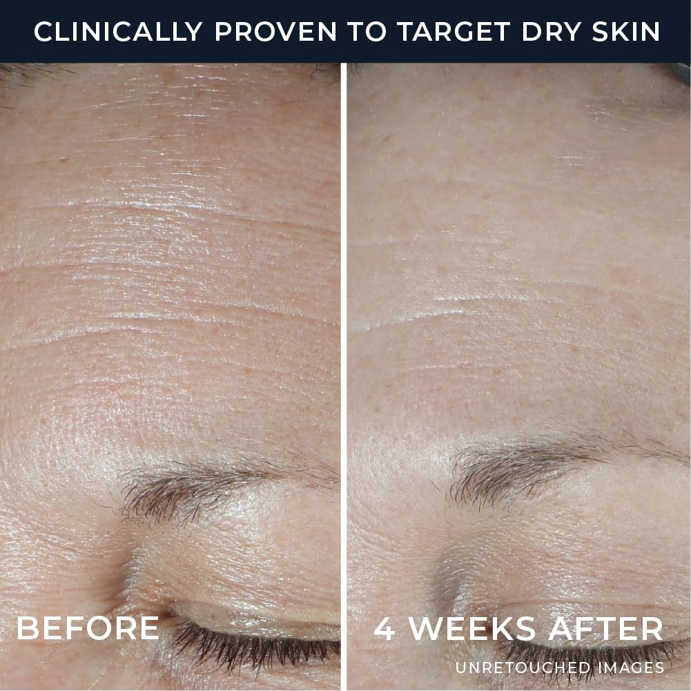 image:imageRoC Hydration Hyaluronic Acid Moisturizer Face Cream Fragrance Free Sensitive Face Moisturizer with Collagen Proteins 17 Ounces with Retinol Eye Cream PacketteHydration Moisturizer