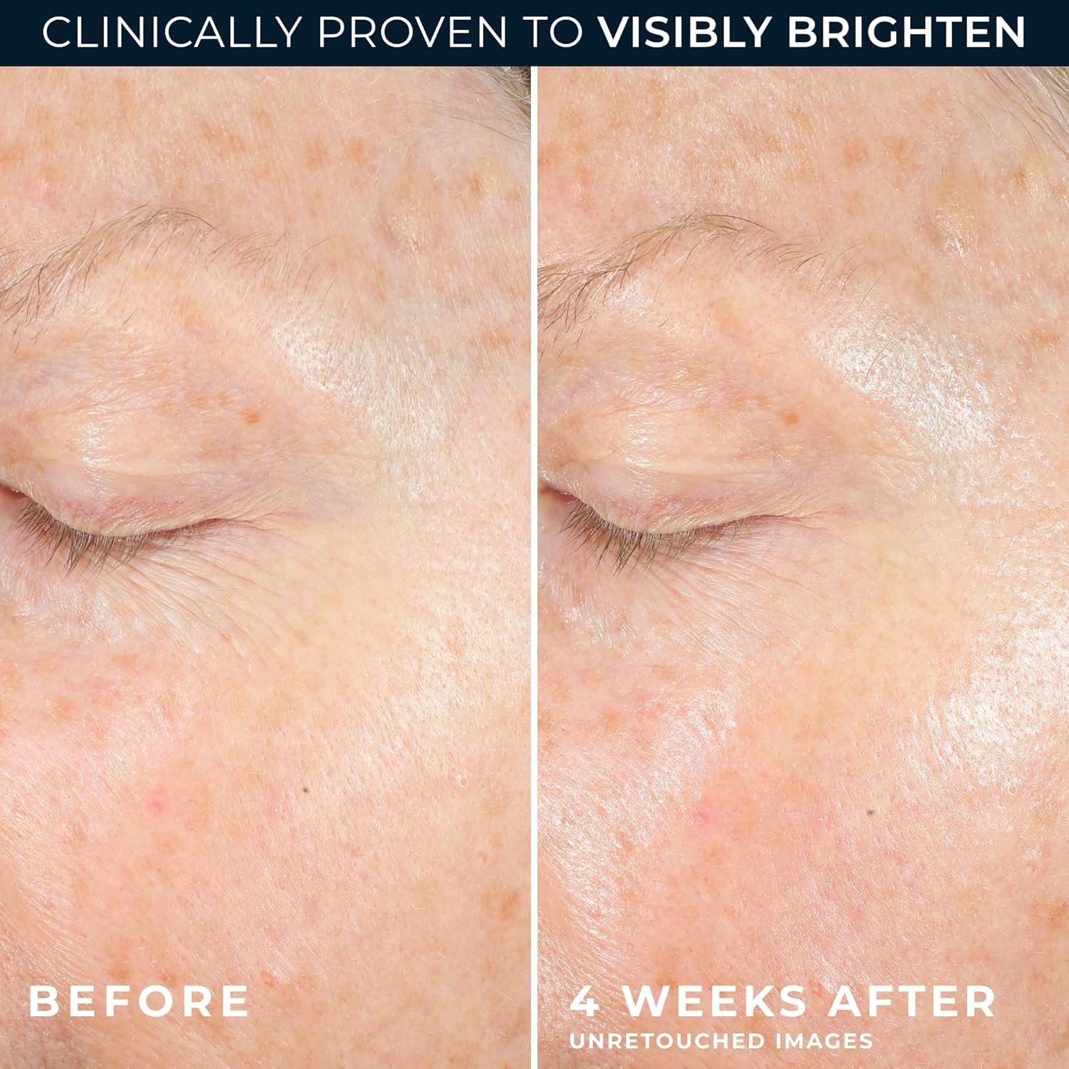 image:imageRoC Multi Correxion Revive Glow Vitamin C Sunscreen Broad Spectrum SPF 30 Face Moisturizer 17 oz with Retinol Eye Cream PacketteVitamin C Gel Cream
