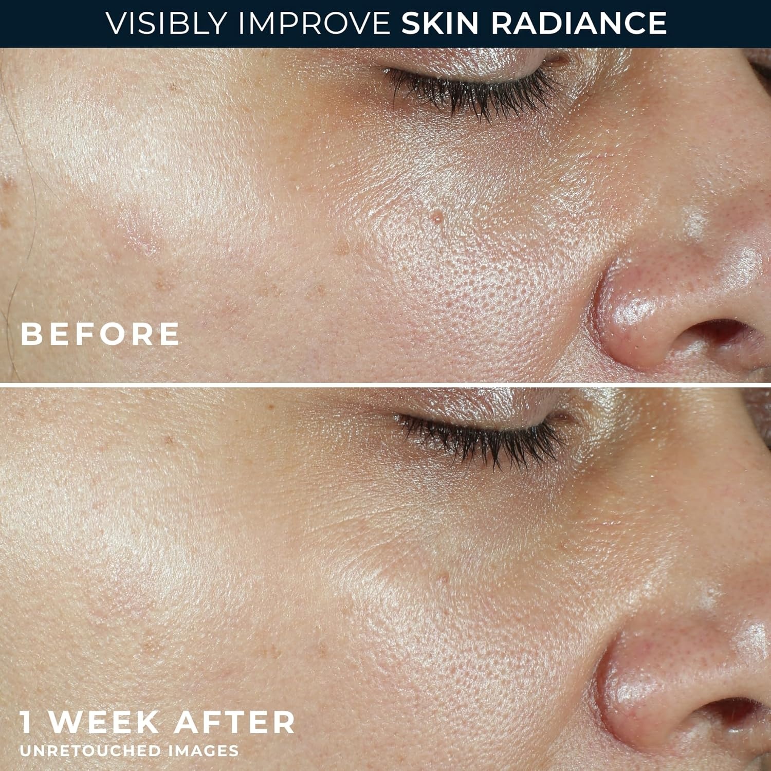 image:imageRoC Multi Correxion Revive Glow Vitamin C Sunscreen Broad Spectrum SPF 30 Face Moisturizer 17 oz with Retinol Eye Cream PacketteVitamin C Moisturizer