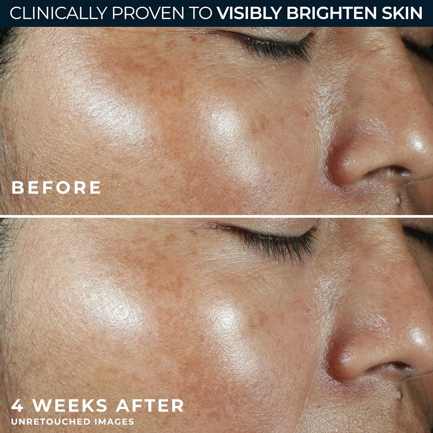 image:imageRoC Multi Correxion Revive Glow Vitamin C Sunscreen Broad Spectrum SPF 30 Face Moisturizer 17 oz with Retinol Eye Cream PacketteVitamin C Moisturizer