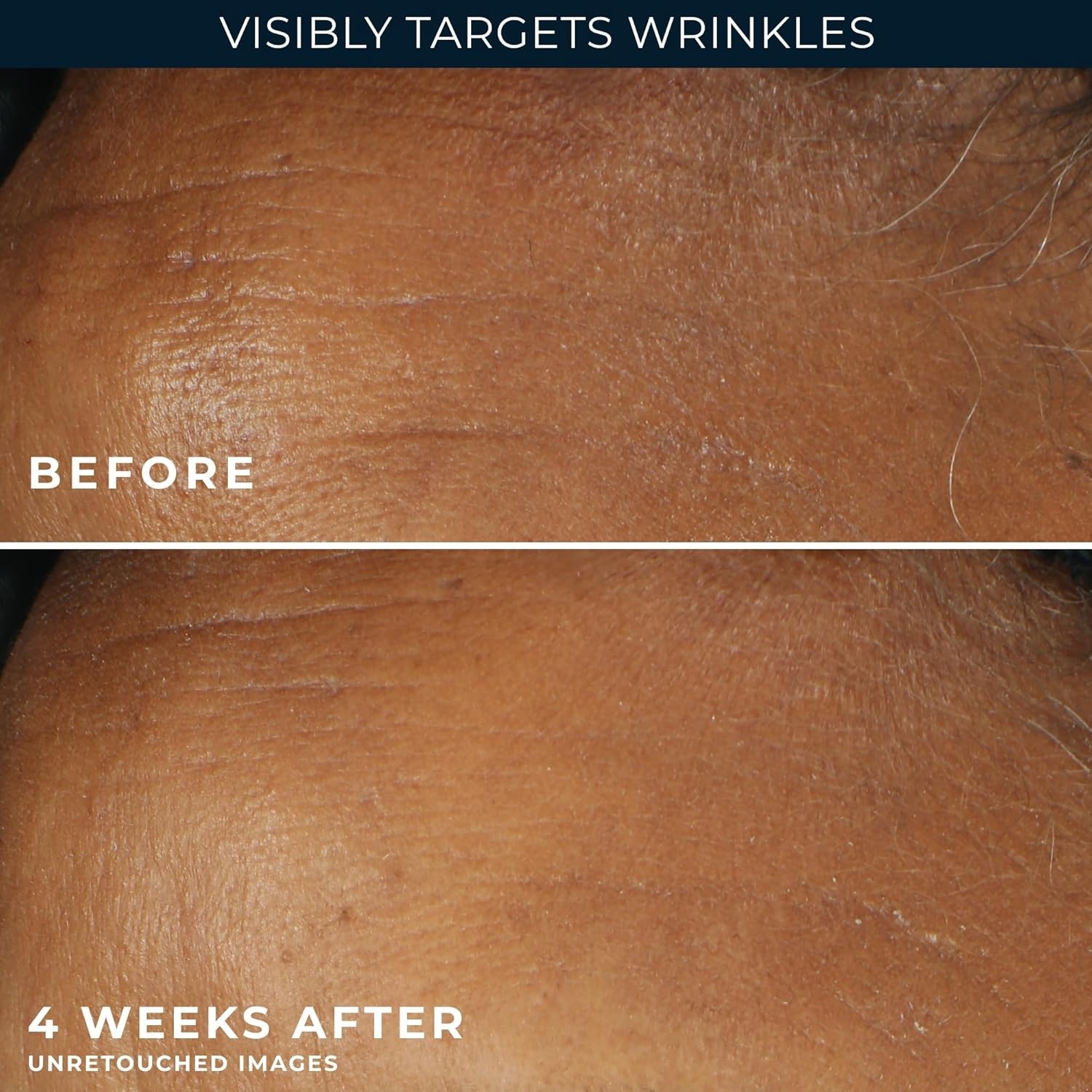 image:imageRoC Retinol Correxion Deep Wrinkle Daily Face Moisturizer with Sunscreen SPF 30 for Fine Lines Dark Spots PostAcne Scars 1 Ounce Packaging May VaryDeep Wrinkle Daily Moisturizer