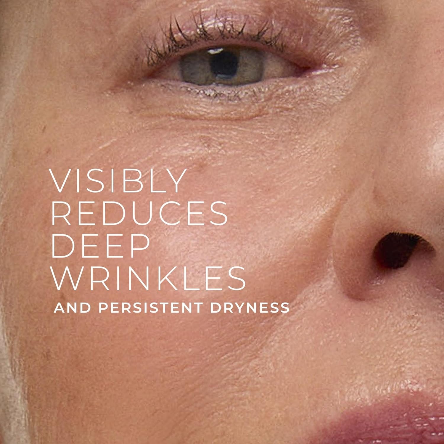 image:imageRoC Retinol Correxion Deep Wrinkle Daily Face Moisturizer with Sunscreen SPF 30 for Fine Lines Dark Spots PostAcne Scars 1 Ounce Packaging May VaryDeep Wrinkle Rich Cream