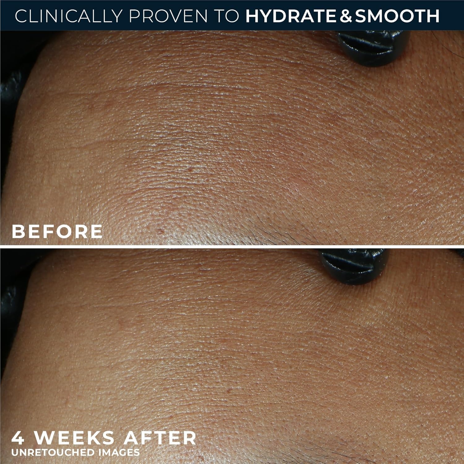 image:imageRoC Retinol Correxion Max Hydration AntiAging Daily Face Moisturizer with Hyaluronic Acid FragranceFree Oil Free Skin Care 17 Ounces Packaging May VaryFragrance Free