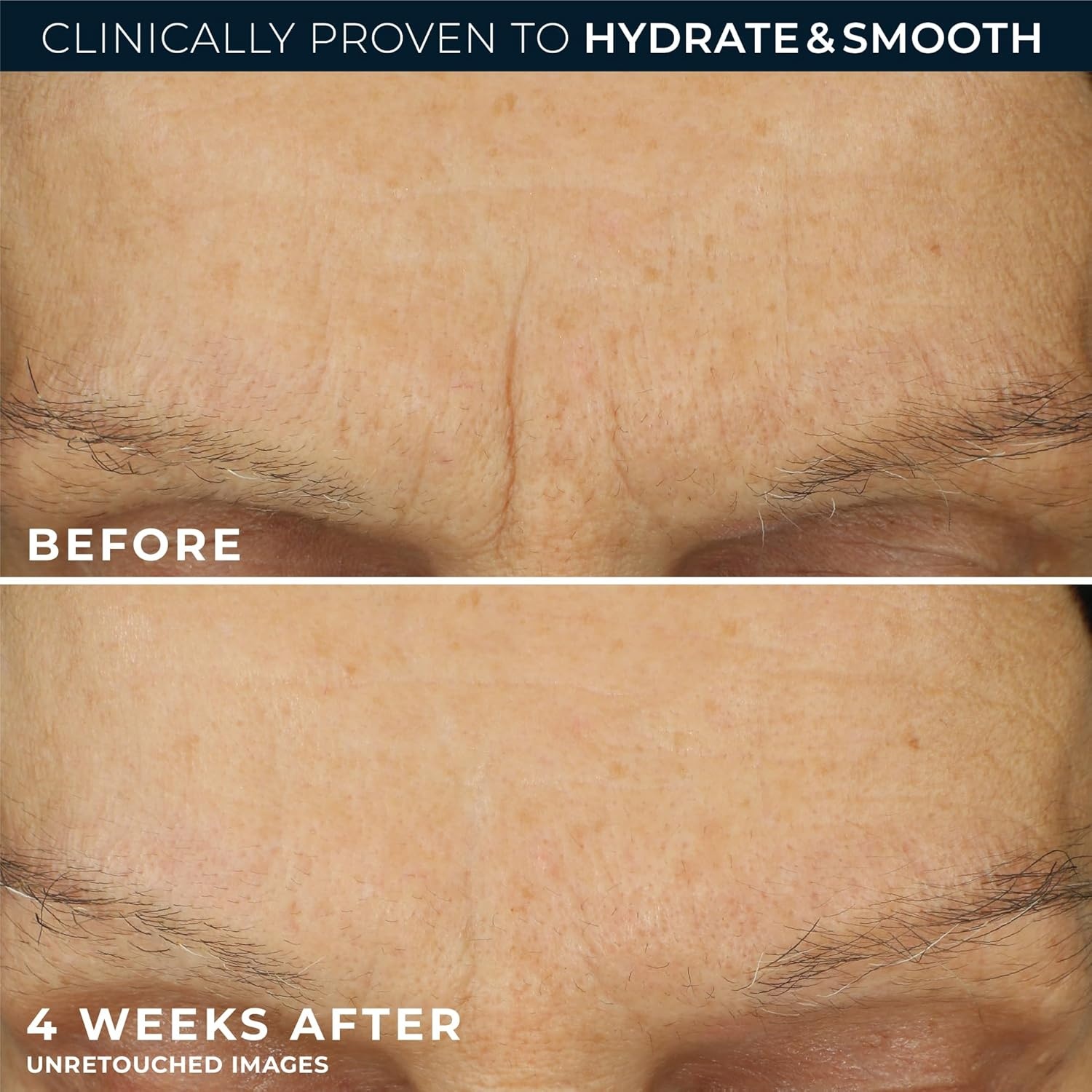 image:imageRoC Retinol Correxion Max Hydration AntiAging Daily Face Moisturizer with Hyaluronic Acid FragranceFree Oil Free Skin Care 17 Ounces Packaging May VaryFragrance Free