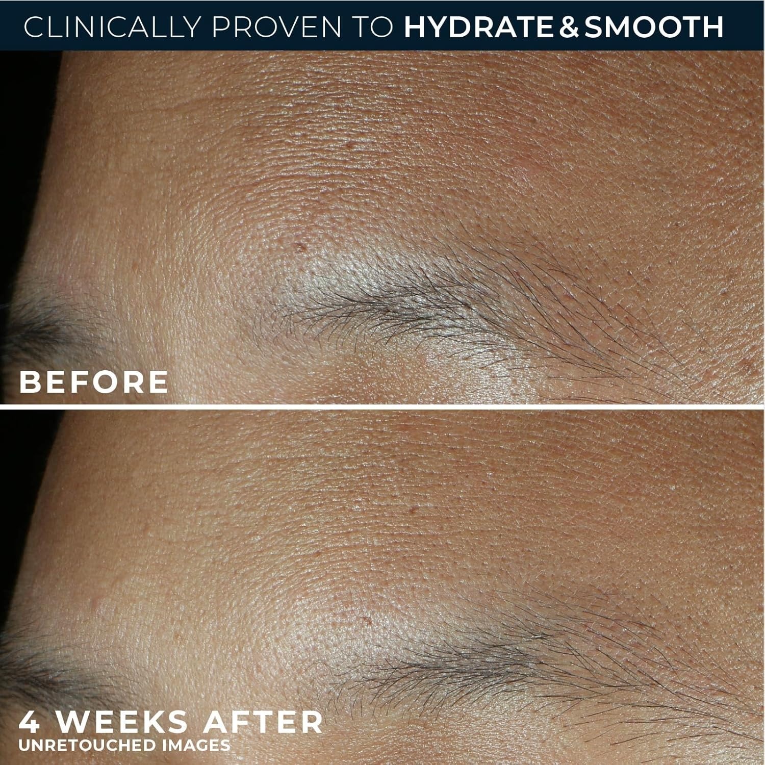 image:imageRoC Retinol Correxion Max Hydration AntiAging Daily Face Moisturizer with Hyaluronic Acid FragranceFree Oil Free Skin Care 17 Ounces Packaging May VaryFragrance Free