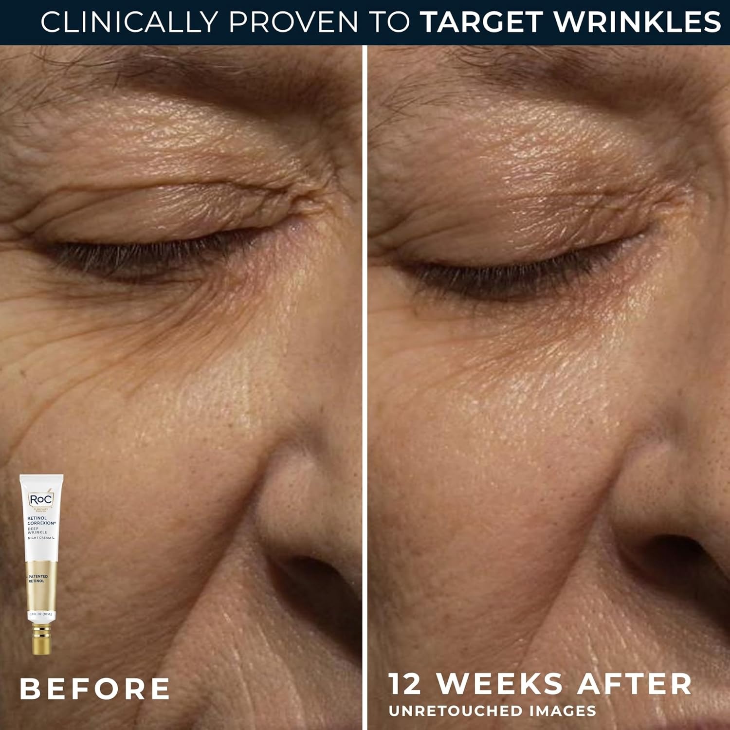 image:imageRoC Retinol Correxion Value Set Duo Deep Wrinkle AntiAging Night Face Cream Under Eye Cream for Dark Circles amp Puffiness Retinol Eye Care15 Fl Oz Pack of 2