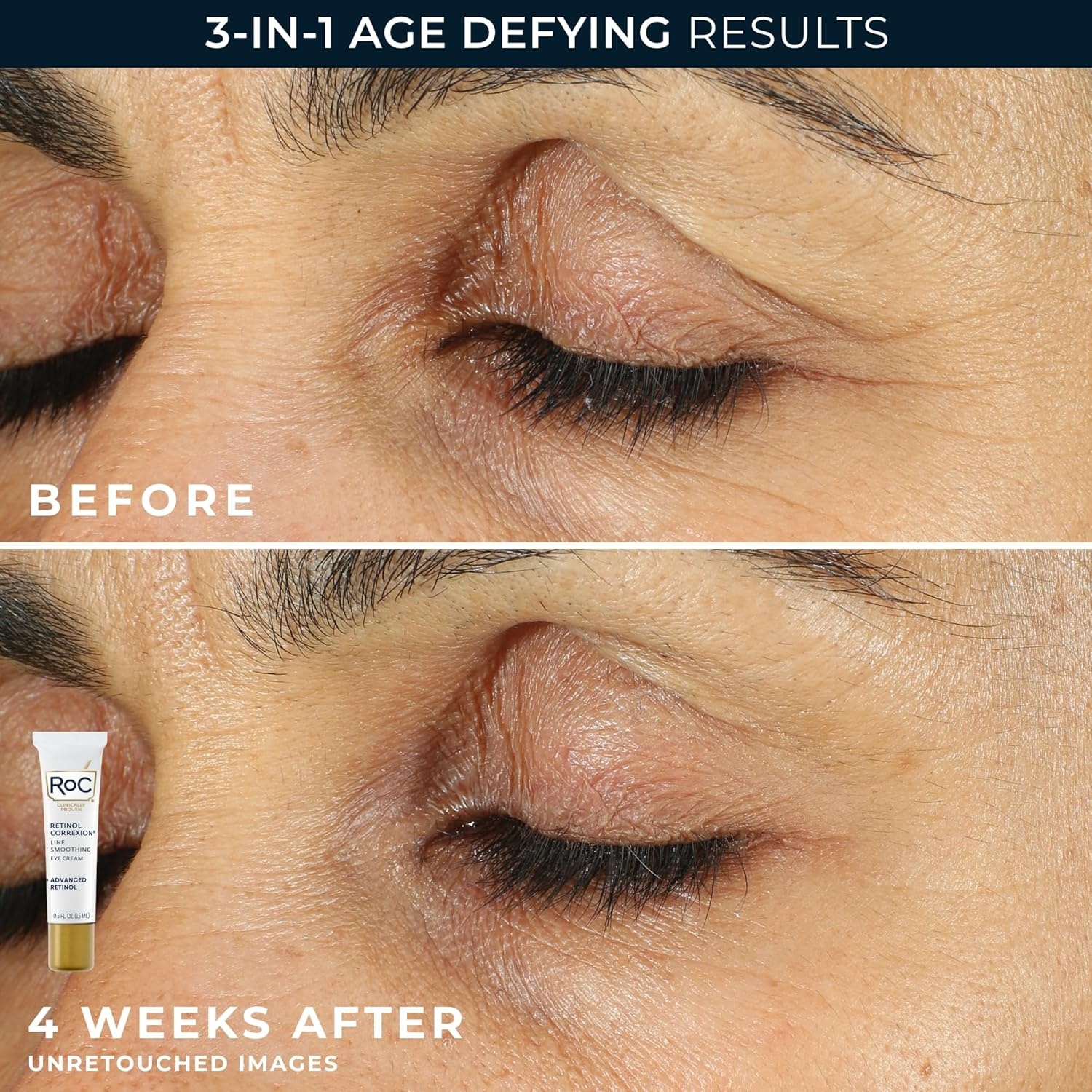 image:imageRoC Retinol Correxion Value Set Duo Deep Wrinkle AntiAging Night Face Cream Under Eye Cream for Dark Circles amp Puffiness Retinol Eye Care2 Piece Set