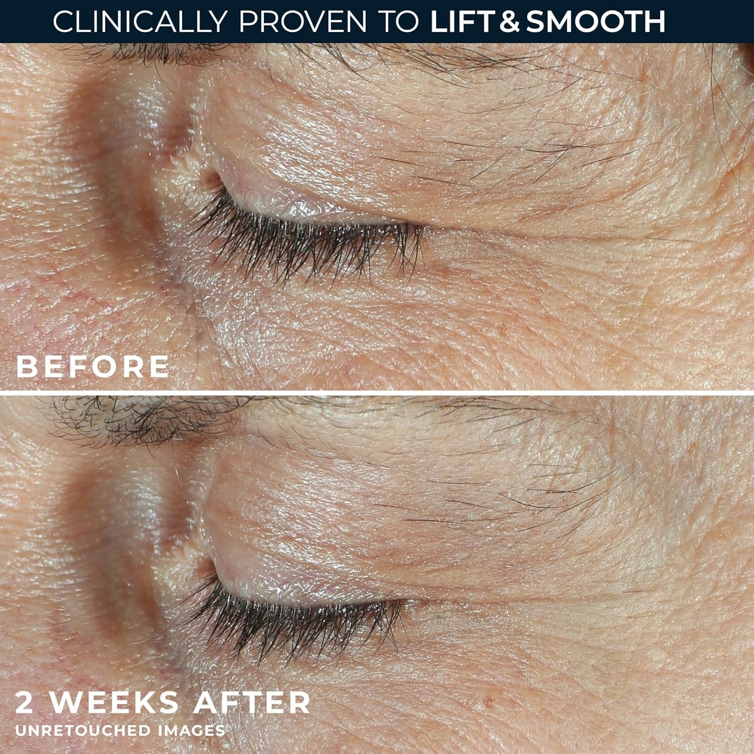 image:imageRoC Derm Correxion Retinol Eye Repair Dark Circle Cream Treatment with Niacinamide Resveratrol Proxygen for Puffy Eyes Wrinkles and Crows Feet Line Smoothing Eye PacketteDual Eye