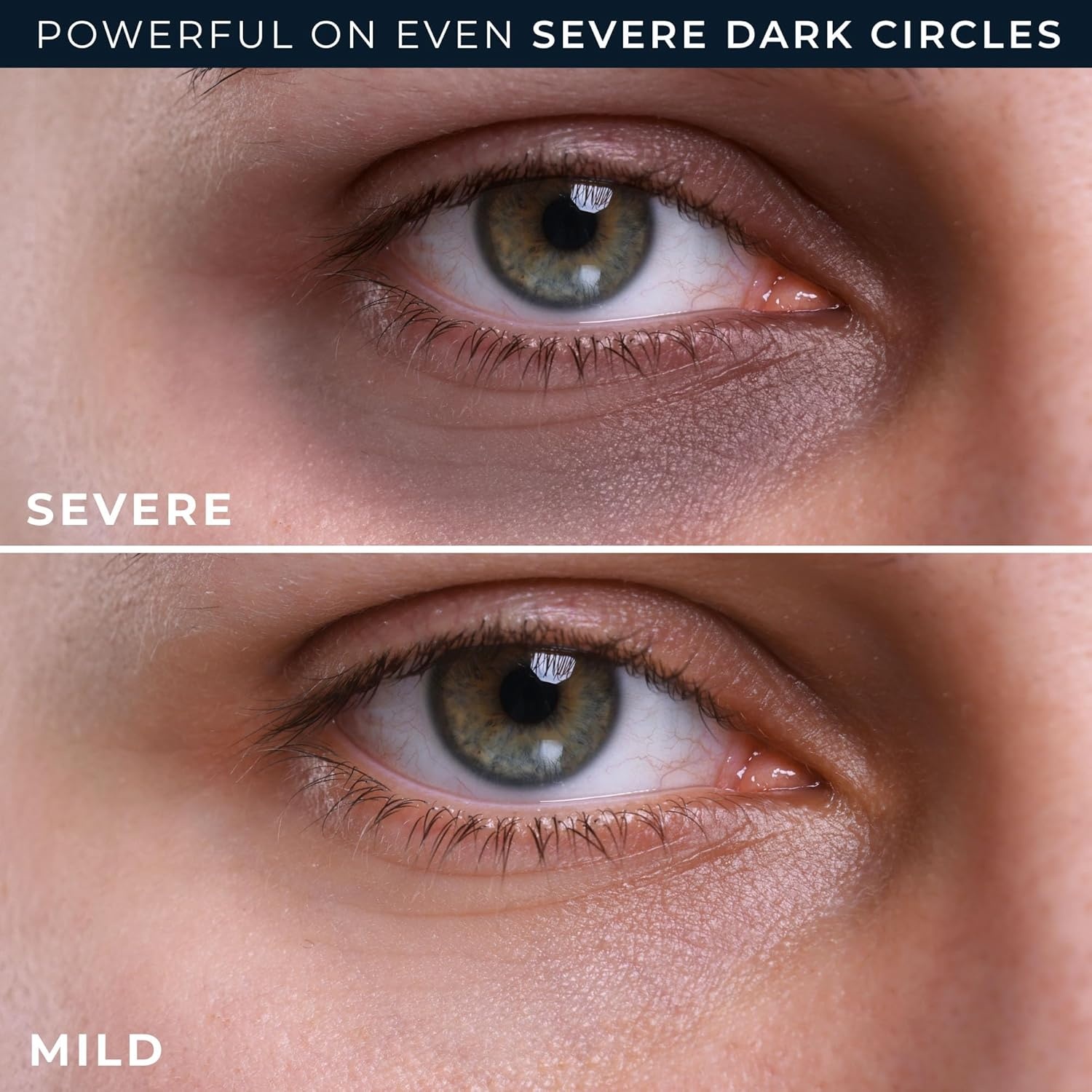 image:imageRoC Derm Correxion Retinol Eye Repair Dark Circle Cream Treatment with Niacinamide Resveratrol Proxygen for Puffy Eyes Wrinkles and Crows Feet Line Smoothing Eye PacketteDark Circle Eye Repair