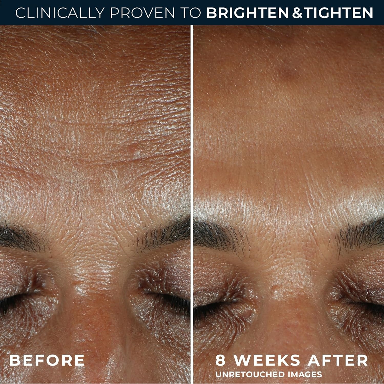 image:imageRoC Multi Correxion Revive Glow Eye Balm with Vitamin C 014 oz Retinol Eye Cream PacketteVitamin C Daily Serum