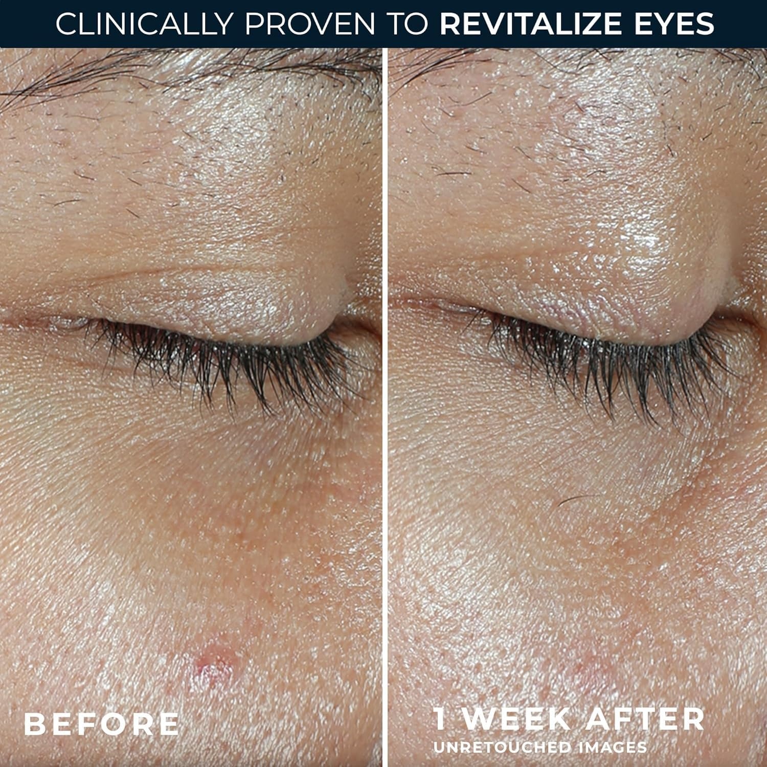 image:imageRoC Multi Correxion Revive Glow Eye Balm with Vitamin C 014 oz Retinol Eye Cream PacketteVitamin C Eye Balm