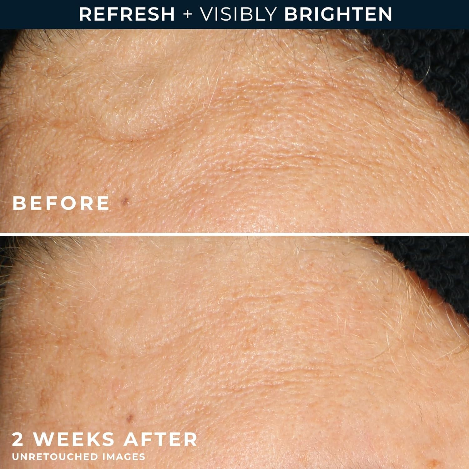 image:imageRoC Multi Correxion Revive Glow Gel Vitamin C Cleanser Face Wash Facial Cleanser with Glycolic Acid ParabenFree SulfateFree Skin Care 6 Ounces6 Fl Oz Pack of 2