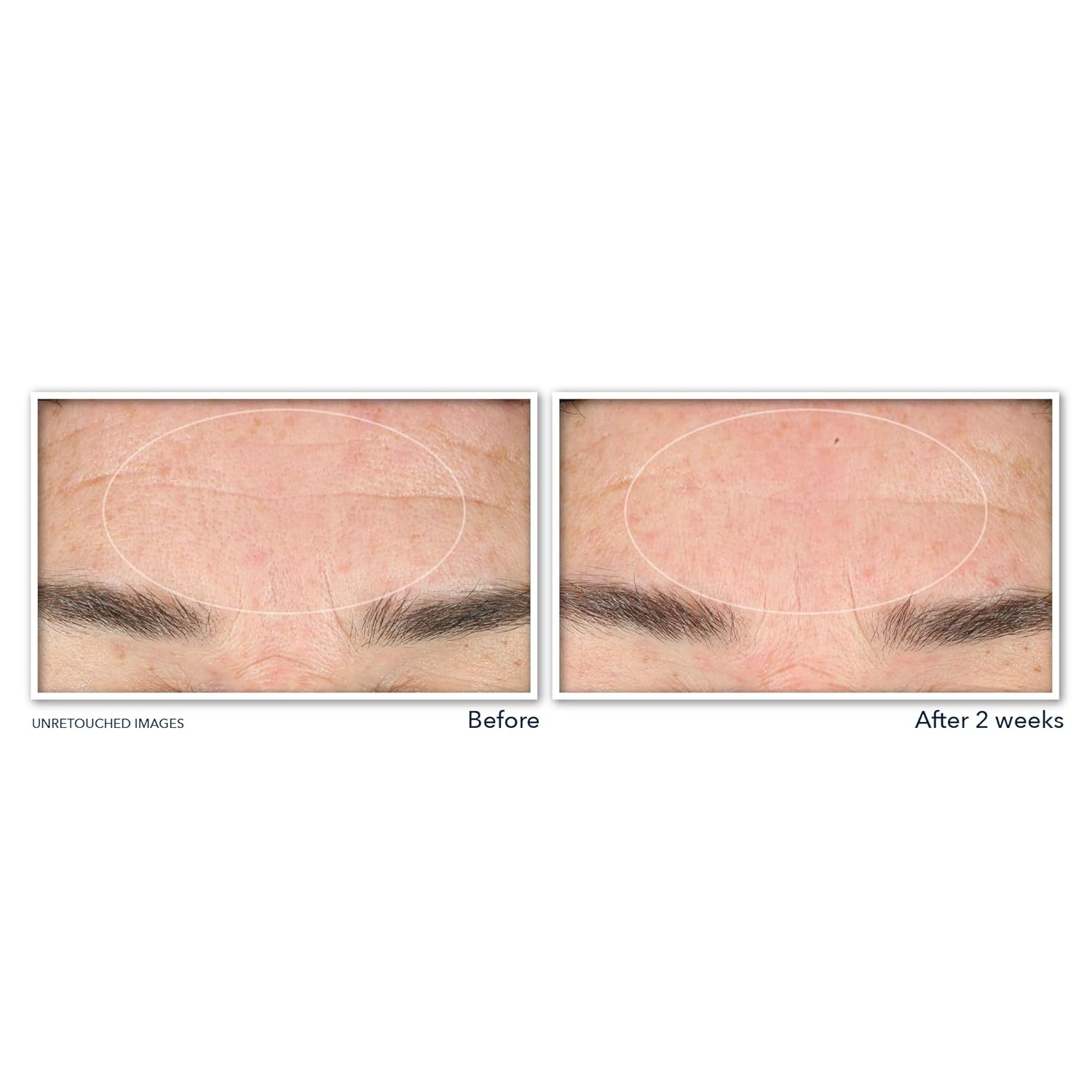image:imageRoC Retinol Correxion Deep Wrinkle Serum Facial Cleanser with Niacinamide for AntiAging amp Fine Lines Makeup Remover Ophthalmologist Tested Skin Care 6 oz6 Fl Oz Pack of 1