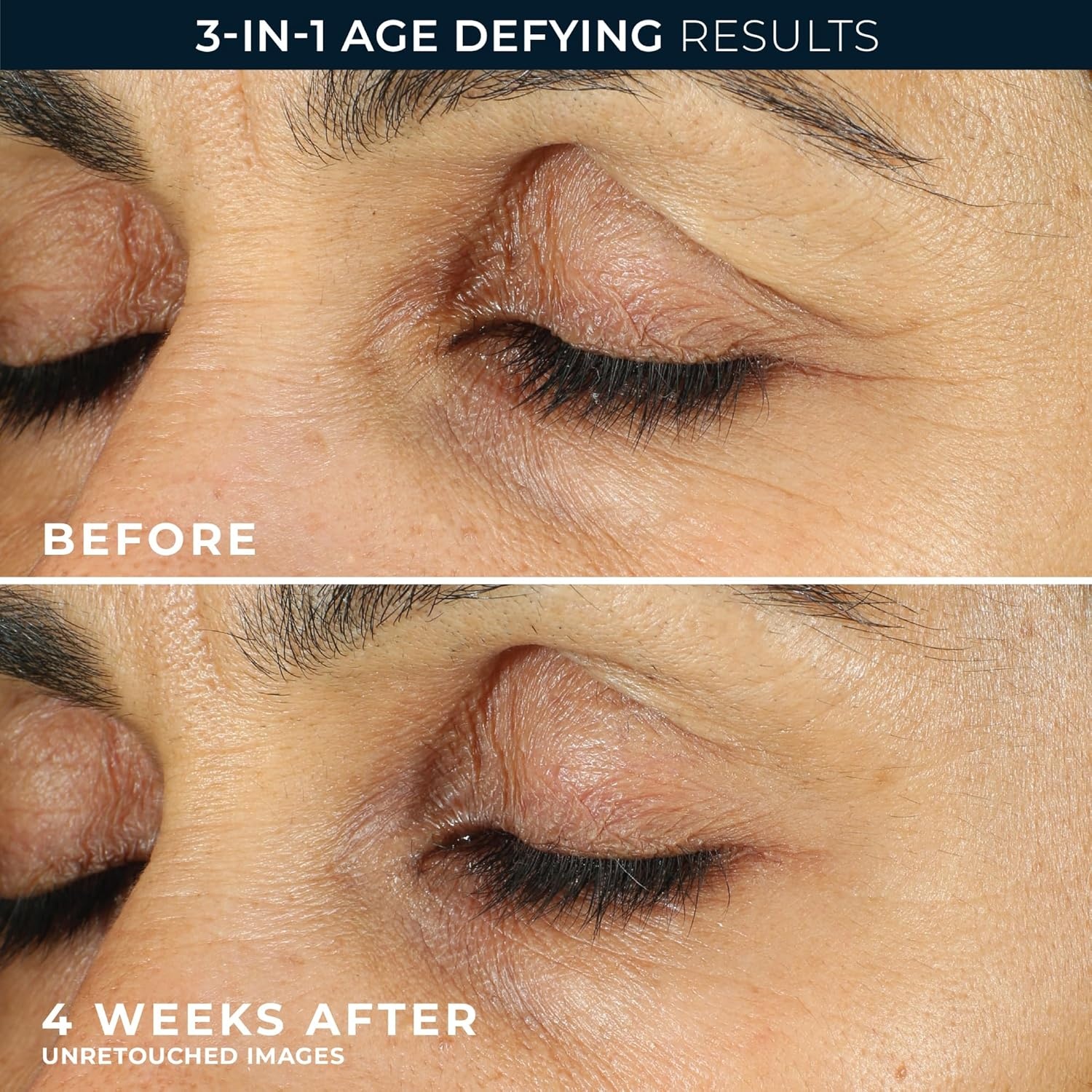 image:imageRoC Retinol Correxion Eye Cream Mini for Dark Circles amp Puffiness Daily Wrinkle Cream Anti Aging Line Smoothing Skin Care Treatment 25 Ounces025 Fl Oz Pack of 1